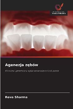 Agenezja zębów