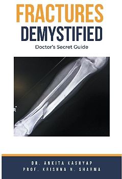 Fractures Demystified