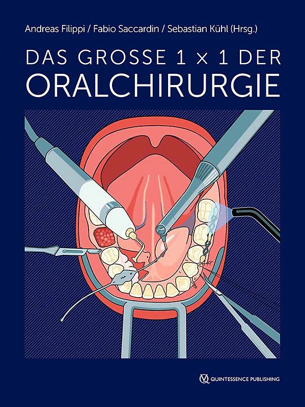 Das große 1 x 1 der Oralchirurgie