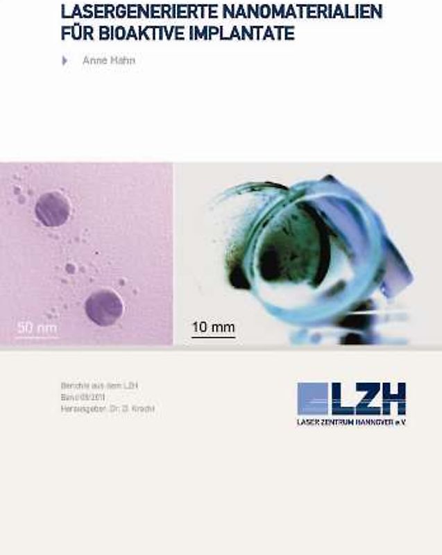 Lasergenerierte Nanomaterialien für bioaktive Implantate