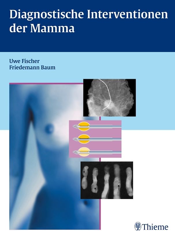 Diagnostische Interventionen der Mamma