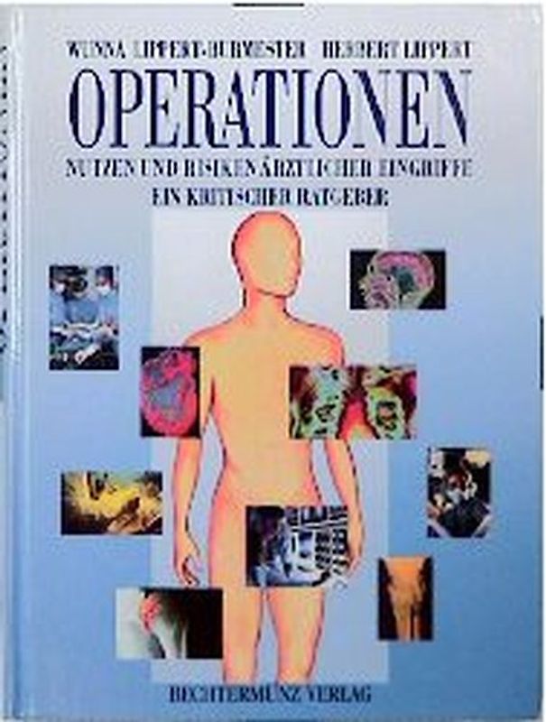 Operationen. Nutzen und Risiken ärztlicher Eingriffe - ein kritischer Ratgeber