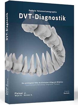 DVT-Diagnostik