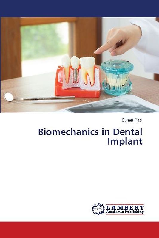 Biomechanics in Dental Implant