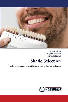 Shade Selection