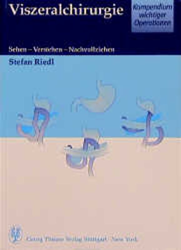Viszeralchirurgie: Kompendium wichtiger Operationen. Sehen - Verstehen - Nachvollziehen