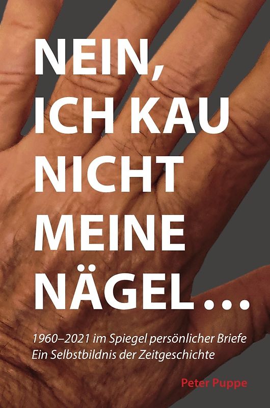 Nein, ich kau nicht meine Nägel...