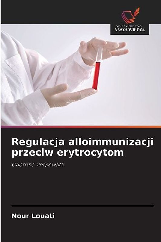 Regulacja alloimmunizacji przeciw erytrocytom