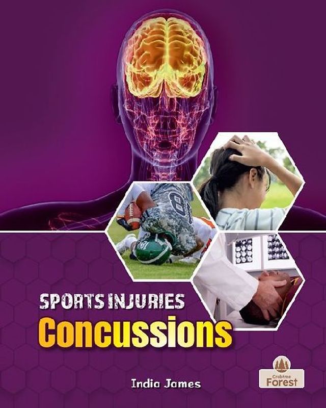 Concussions