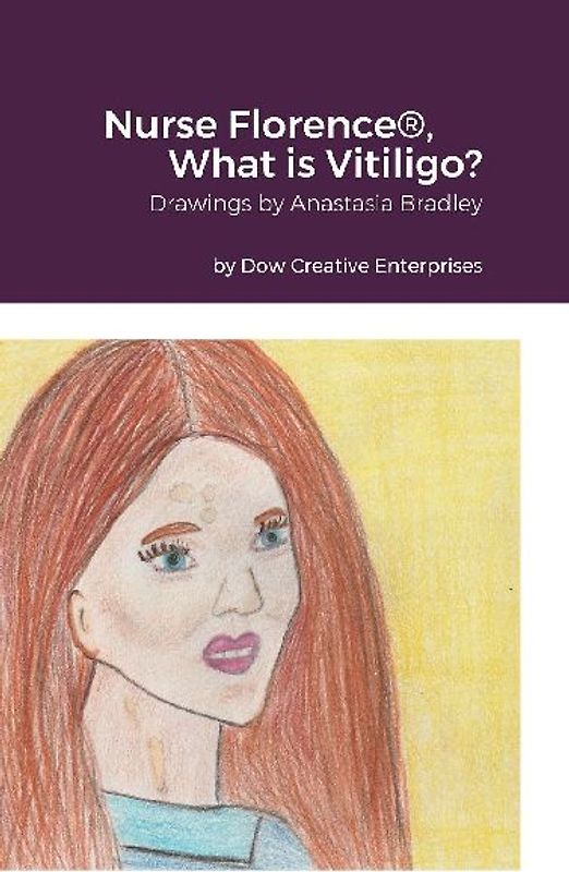 Nurse Florence®, What is Vitiligo?