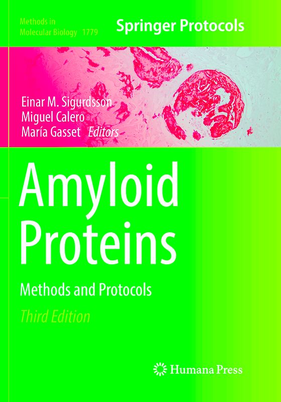 Amyloid Proteins