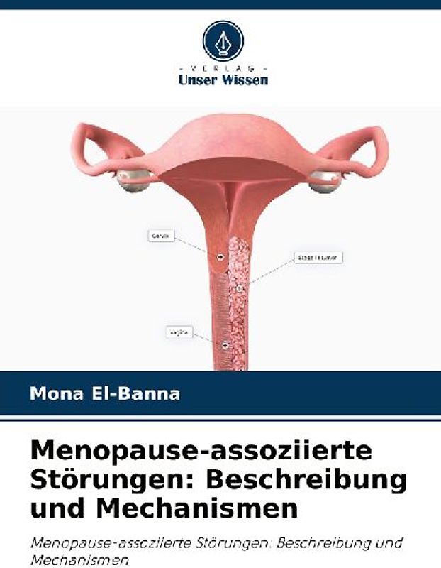 Menopause-assoziierte Störungen: Beschreibung und Mechanismen