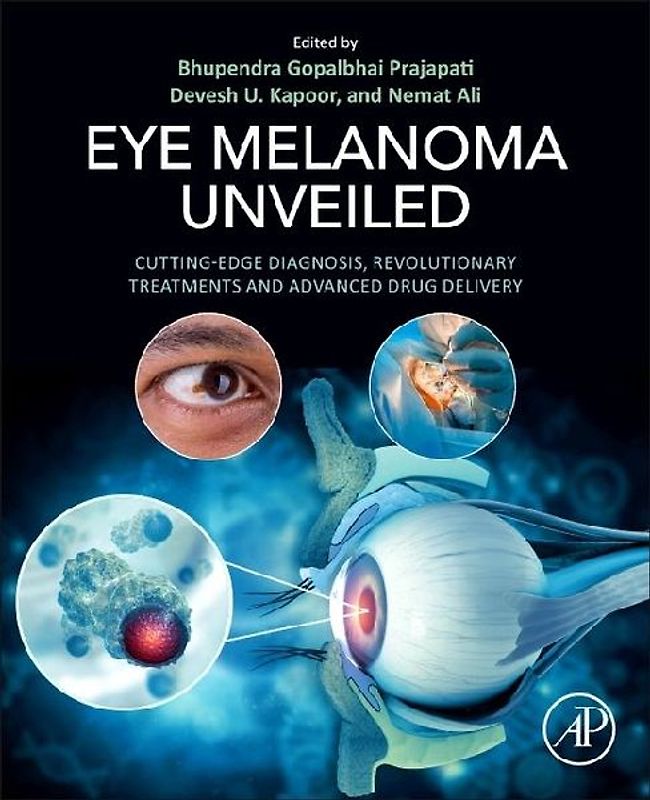 Eye Melanoma Unveiled