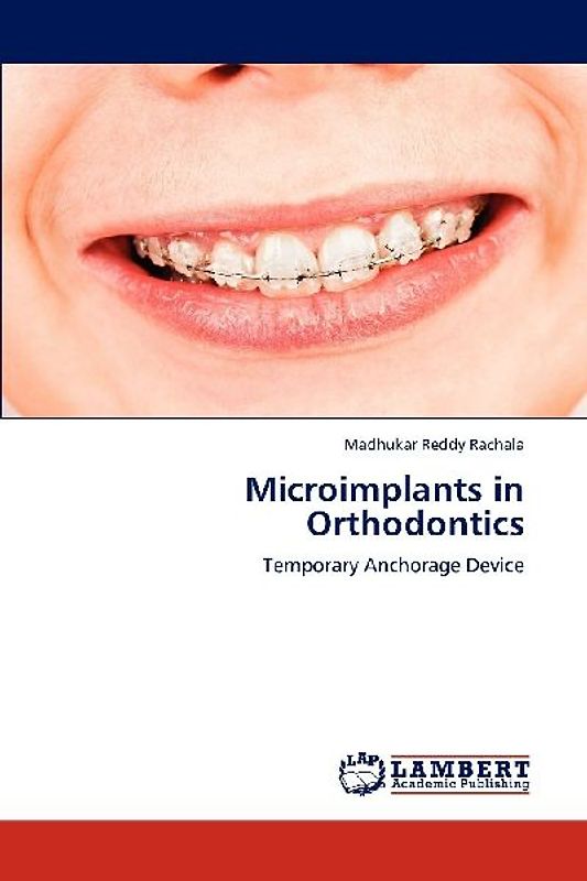 Microimplants in Orthodontics
