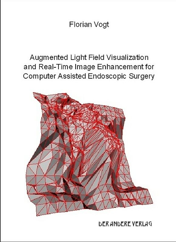 Augmented Light Field Visualization and Real-Time Image Enhancement for Computer Assisted Endoscopic Surgery
