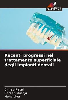 Recenti progressi nel trattamento superficiale degli impianti dentali