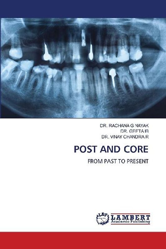 POST AND CORE