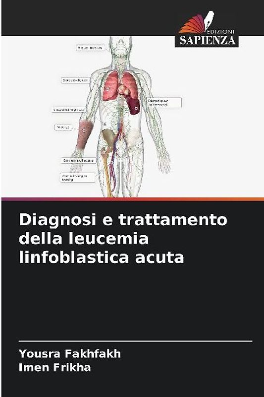 Diagnosi e trattamento della leucemia linfoblastica acuta
