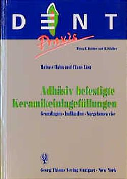 Adhäsiv befestigte Keramikeinlagefüllungen