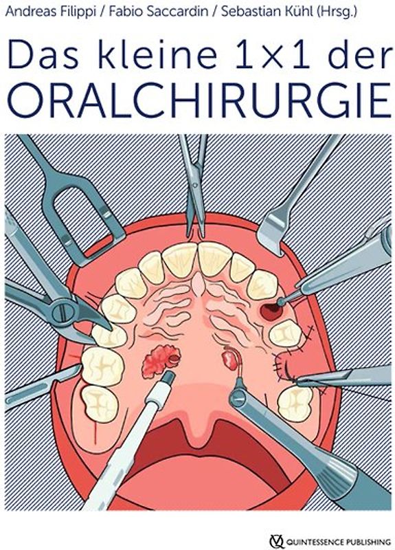 Das kleine 1 x 1 der Oralchirurgie