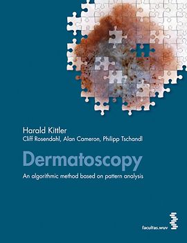 Dermatoscopy