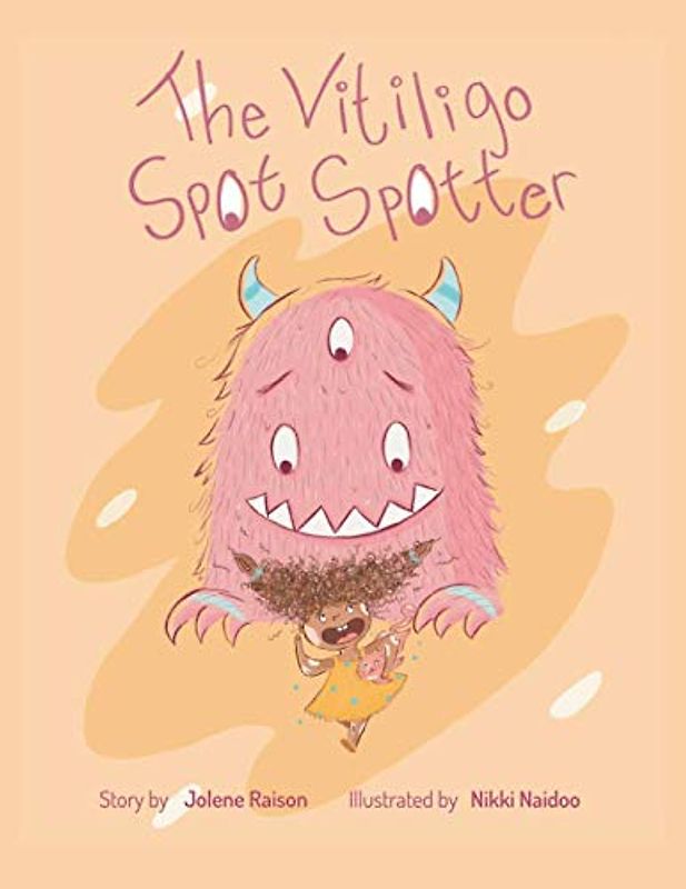 The Vitiligo Spot Spotter