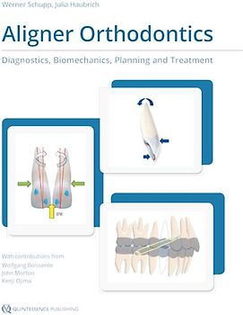 Aligner Orthodontics