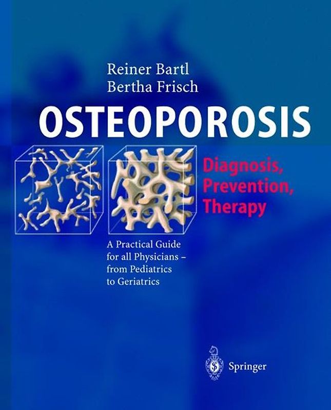 OSTEOPOROSIS