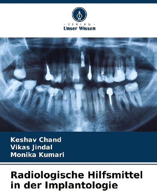 Radiologische Hilfsmittel in der Implantologie