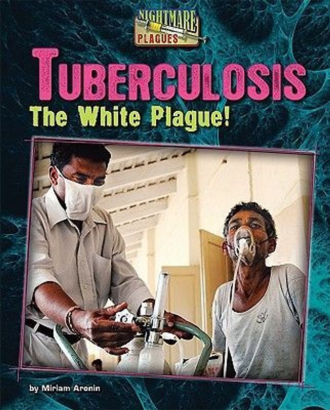 Tuberculosis
