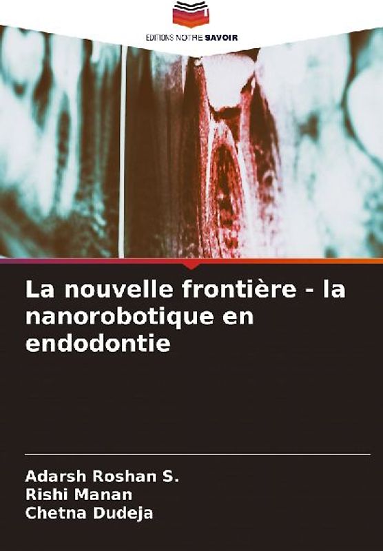 La nouvelle frontière - la nanorobotique en endodontie