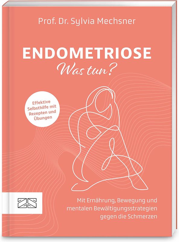 Endometriose – Was tun?