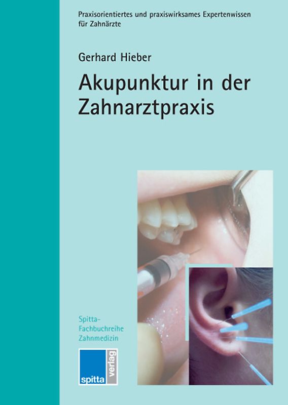 Akupunktur in der Zahnarztpraxis