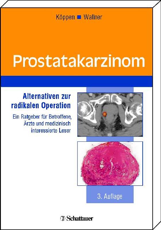 Prostatakarzinom