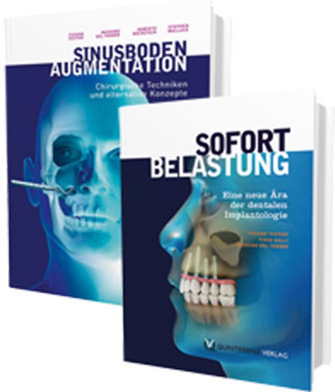 Sinusbodenaugmentation und Sofortbelastung