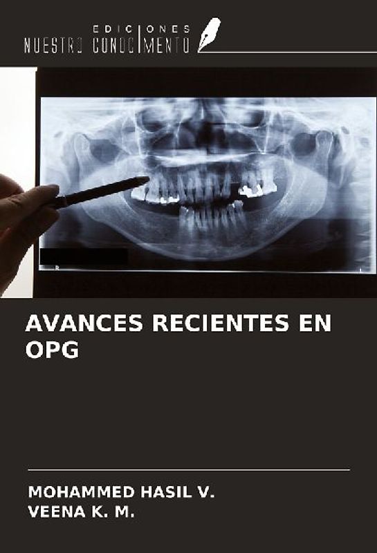 AVANCES RECIENTES EN OPG