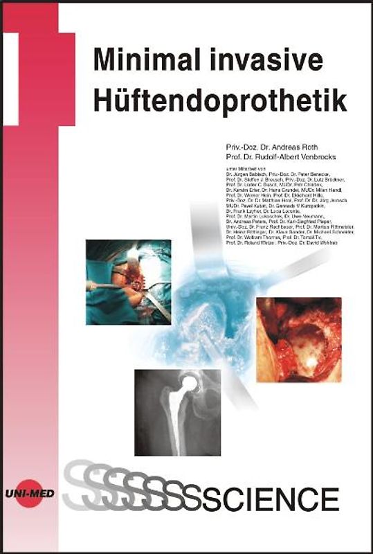 Minimal invasive Hüftendoprothetik