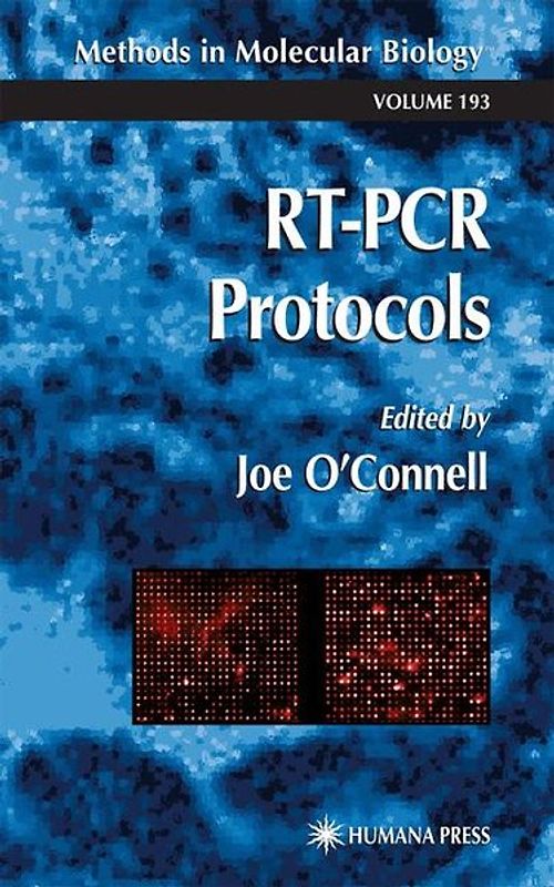 RT-PCR Protocols