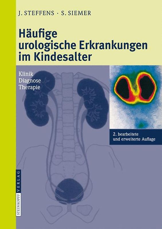 Häufige urologische Erkrankungen im Kindesalter