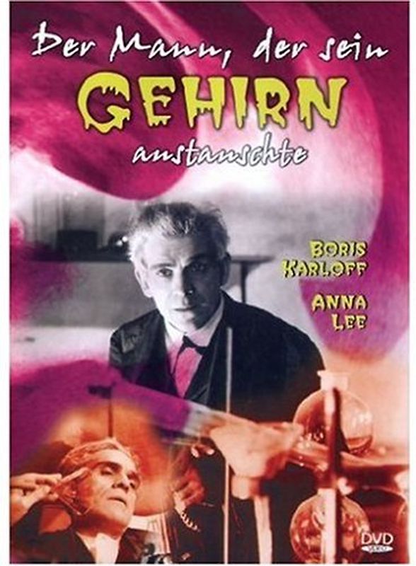 Der Mann, der sein Gehirn austauschte DVD