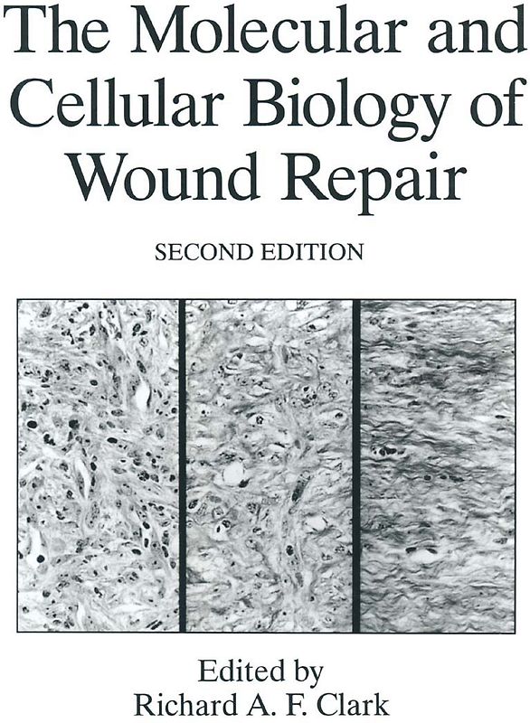 The Molecular and Cellular Biology of Wound Repair