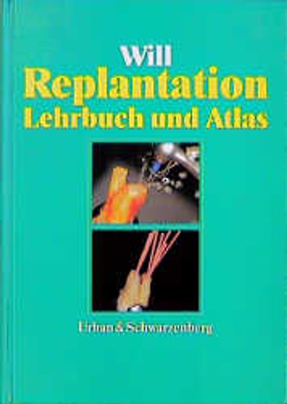 Replantation