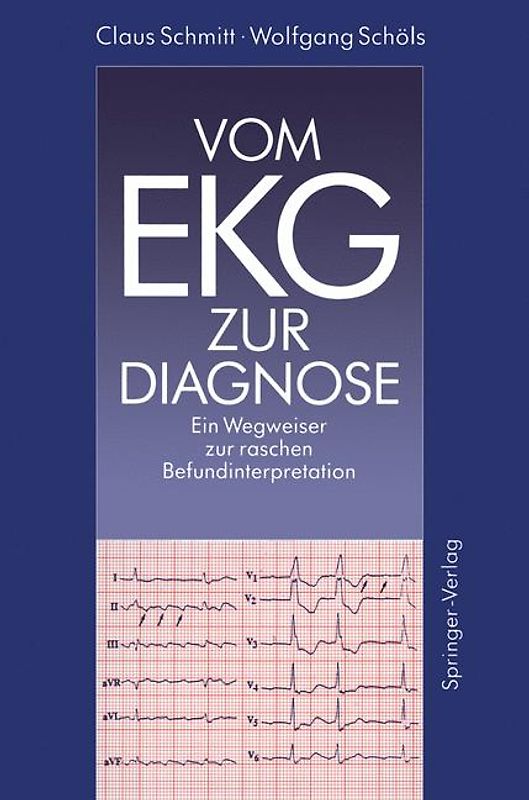 Vom EKG zur Diagnose