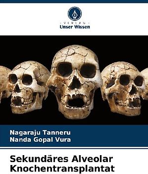 Sekundäres Alveolar Knochentransplantat