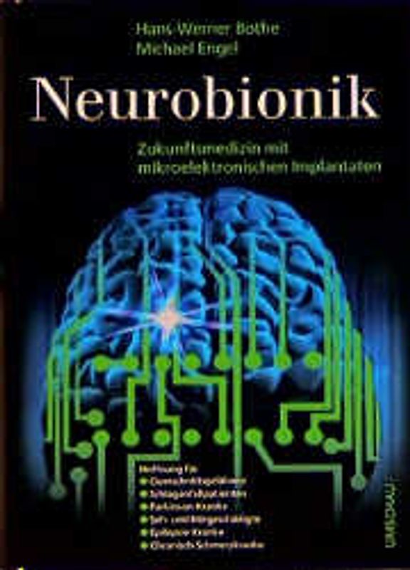 Neurobionik. Zukunftsmedizin mit mikroelektronischen Implantaten