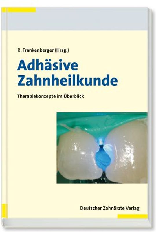 Adhäsive Zahnheilkunde