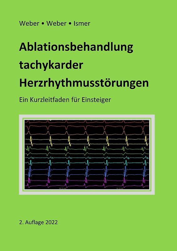Ablationsbehandlung tachykarder Herzrhythmusstörungen