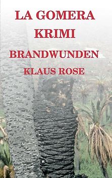 Brandwunden