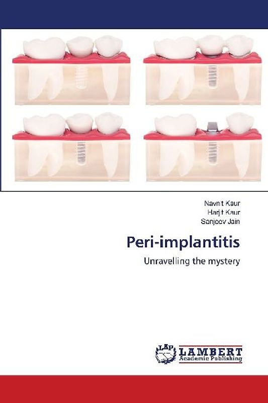 Peri-implantitis