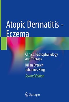 Atopic Dermatitis - Eczema
